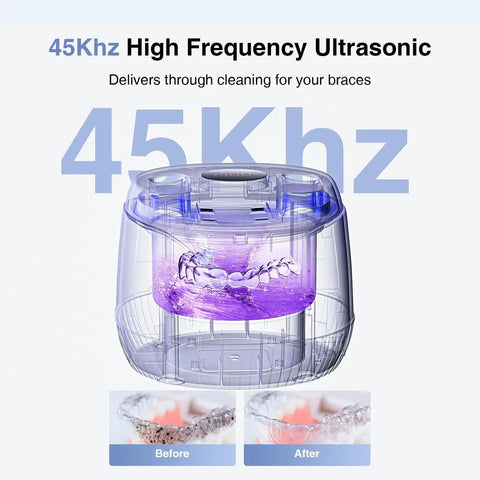 Retainer Cleaner Machine With 45kHz Ultrasonic Cleaning And LED Digital Timer 200ml Capacity shown cleaning braces effectively