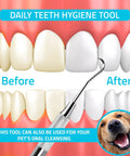 Dentist Grade Tartar Scraper Tool For Plaque Removal Stainless Steel Dental Pick showing before and after teeth cleaning results