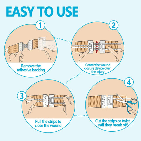 Emergency wound closure kit 2-pack; four-step diagram showing adhesive strips, closure device, and scissors