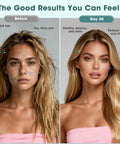 Before and after comparison of woman's skin condition; left with dull hair, dry skin, right with healthy, smooth hair and skin.
