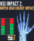 X-ray of hand with impact dampening stats and ANSI ISEA 138 rating chart for Deep II Grip Extrication Gloves With PVC Palm And Kevlar Stitching For Men Red Palm Large Durable Grippy Impact Ready For Heavy Duty Work ANSI Cut A2 Rated Skid X Rough Palm For Superior Grip And Durability With Moisture Wicking Suede Inner.
