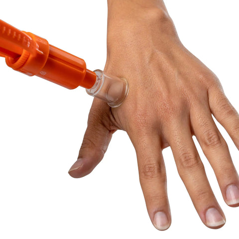 Ven Ex Snake Bite Kit And Bee Sting Kit with Portable Venom Extractor applying suction on hand outdoors