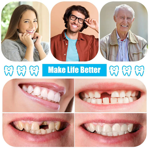 Collage showing smiling faces and close-ups of teeth, promoting DIY Denture Repair Kit For Fake Teeth 35 Piece Set With Dental Tools.