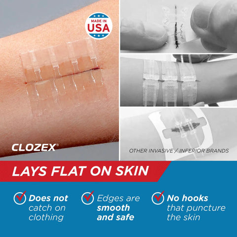Emergency Wound Closure Without Stitches Quick Skin Closure Device For Two Lacerations Or One Long 2 Inch Repair FSA HSA Eligible Includes Two Sterile 1 Inch Closures For Easy At Home Or On The Go Wound Care