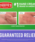 Night Treatment Hand Cream For Extremely Dry And Cracked Hands, Before and after results, O'Keeffe's brand, 2-week transformation