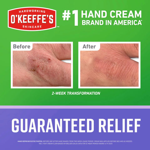 Night Treatment Hand Cream For Extremely Dry And Cracked Hands, Before and after results, O'Keeffe's brand, 2-week transformation
