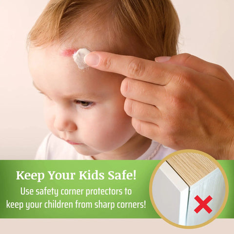 Child with bandage on forehead and hand applying ointment, emphasizing the need for Clear Corner Protectors For Furniture 12 Pack With T Shape Edge Guards Baby Proof Cushions Silicone 30 Mm Small Full Corner Coverage For Tables Desks Nightstands Non Toxic Easy Install Durable Kid Safe to prevent injuries.