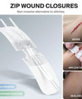 SurviveX Zip Wound Closures device, white front view with dual adhesive strips