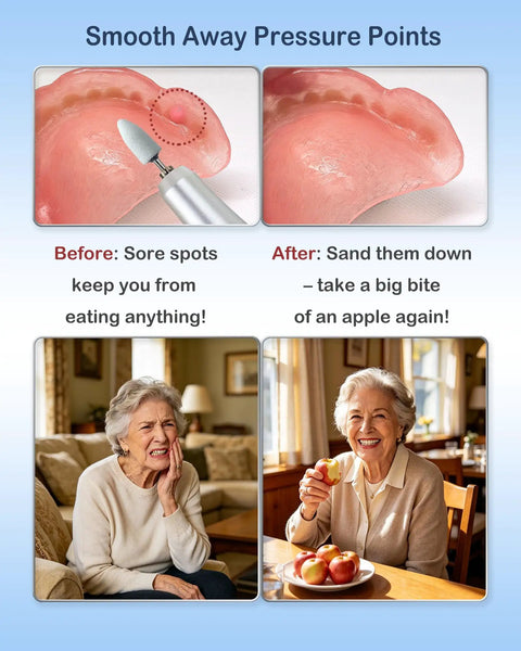 High Speed USB C Corded Polishing Kit for Acrylic Bases demonstration on denture, reducing sore spots for better fit.