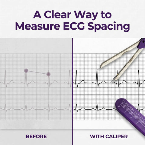 Top Tier Purple EKG Calipers That Deliver Dead On Measurements For Lightning Swift ECG Grid Analysis And Smooth Daily Charting Trusted By Clinical Teams Nationwide