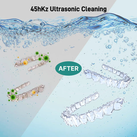 Ultrasonic Retainer Cleaner With UV Lights 45kHz Deep Cleaning Pod showing before and after aligner cleaning results with bubbles