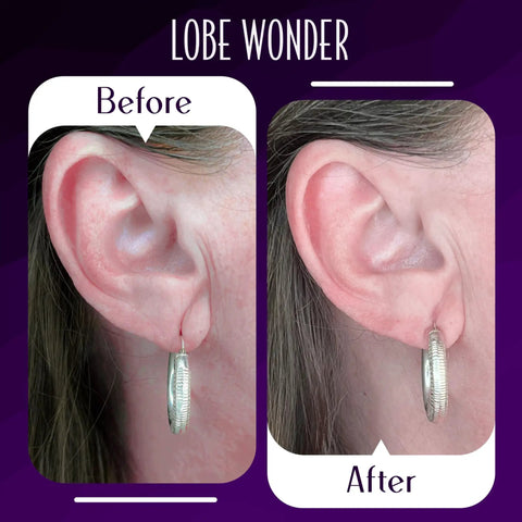 Comparison of ears with Clear Latex Free Ear Lobe Support Patch For Pierced Ears That Instantly Lifts And Protects Prevents Torn Or Stretched Lobes Nearly Invisible Earring Back Alternative For All Styles And Sizes 60 Patches