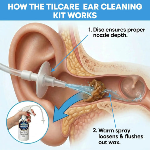 All In One Ear Wax Removal Kit For Home Use For Adults And Kids With Basin Bulb Syringe Four Piece Curette Set Microfiber Towel And 30 Disposable Tips showing ear irrigation