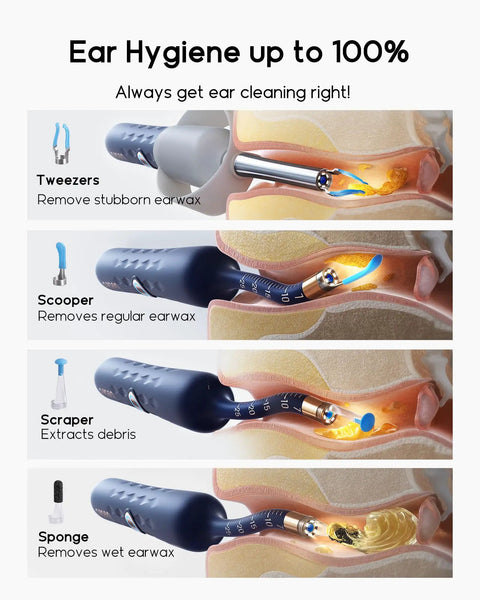 Earsight Plus D39R Ear Wax Removal Tool Camera Kit showing tweezers, scooper, scraper, and sponge in use.