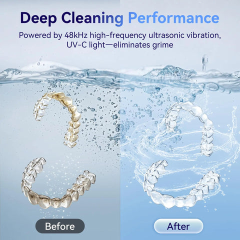 48kHz Ultrasonic Retainer Cleaner Machine For Dental Care Deep Clean Retainers Dentures Braces Mouth Guards Night Guards With Micro Bubble Cleaning Power Gentle Safe Professional Home Use Keeps Aligners Sparkling before and after aligner cleaning