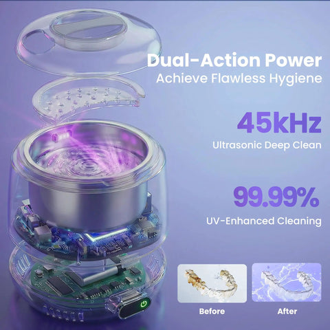 Ultrasonic Retainer Cleaner With UV Light And 45KHz Cleaning Pod, 4 Modes, Detachable Design featuring internal components