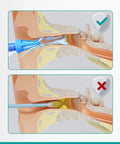 Easy Water Rinse Ear Wax Removal Kit With 3 Quad Stream Tips for safe cleaning and cotton swab comparison in ear canal illustration
