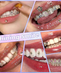 Collage of teeth adorned with colorful gems from Tooth Gem Kit for Teeth Beginners with Colorful Crystal Gems and Essential Tools.