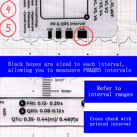 Triple Pack ECG 7 Step Ruler Set For ECG EKG Interpretation, Transparent Plastic Calipers Measuring Tool, showing PR & QRS intervals