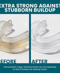 Before and after using Extra Strength Retainer And Denture Cleaning Tablets 8 Month Supply Removes Odor, Stains, Plaque, And Discoloration