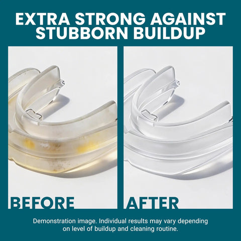 Before and after using Extra Strength Retainer And Denture Cleaning Tablets 8 Month Supply Removes Odor, Stains, Plaque, And Discoloration