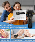 Couple excitedly holding the Waterproof Electric Foot Callus Remover With Three Roller Heads Two Speed Settings Battery Display At Home 17 In 1 Rechargeable Pedicure Kit