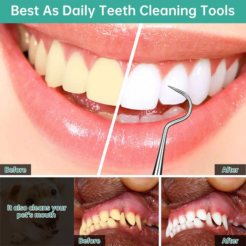 Pro Grade Dental Scraper Tool For Teeth Cleaning Stainless Steel Dentist Pick Tartar Remover for before and after oral care