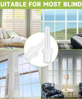 Top Shelf Window And Shutter Repair Kit With Sixty Badass Plastic Pins Spring Locks And Clips quick install for various blinds.