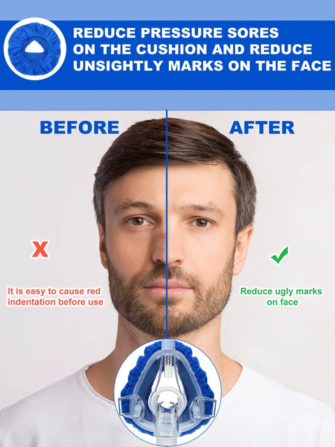 Before and after effects of 24 Pack Full Face Mask Liners For Comfy Comfort And Leak Prevention Reusable Soft Cushions in blue.