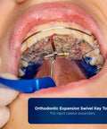 Orthodontic Expansion Swivel Key Tool For Palatal Expanders Easy Turn 3 Pack With Medical Grade Stainless Steel Pin And BPA Free Food Grade Plastic Handle By Galvanox in use with rapid palatal expander in mouth