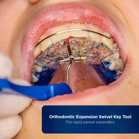 Orthodontic Expansion Swivel Key Tool For Palatal Expanders Easy Turn 3 Pack With Medical Grade Stainless Steel Pin And BPA Free Food Grade Plastic Handle By Galvanox in use with rapid palatal expander in mouth