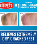 Before and after images showing results of Healthy Feet Foot Cream With Concentrated Moisture Lock for extremely cracked dry feet.