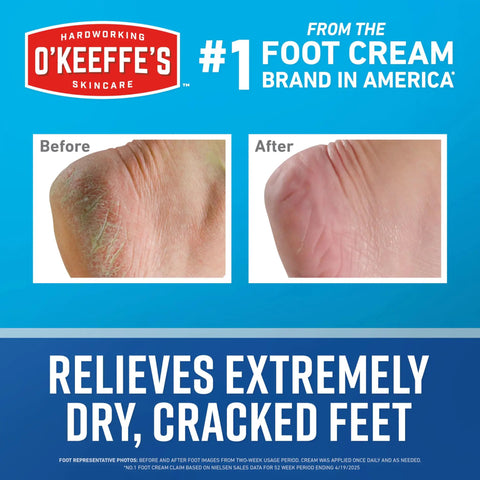 Before and after images showing results of Healthy Feet Foot Cream With Concentrated Moisture Lock for extremely cracked dry feet.