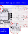 Triple Pack ECG 7 Step Ruler Set For ECG EKG Interpretation, Transparent Plastic Calipers Measuring Tool with reference guide.