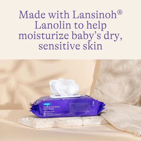 Ultra Gentle Baby Wipes With Lanolin For Sensitive Skin Hypoallergenic And Lightly Scented Six Pack Of 480 Wipes package image