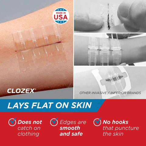 Emergency Laceration Kit For Quick Wound Closure Without Stitches, FSA HSA Eligible, Includes Two Sterile Closures One Inch And One And A Half Inch, Gauze Pads, Alcohol Pads, And Cover Bandages For Two Wounds Or Combined For Up To Two And A Half Inch