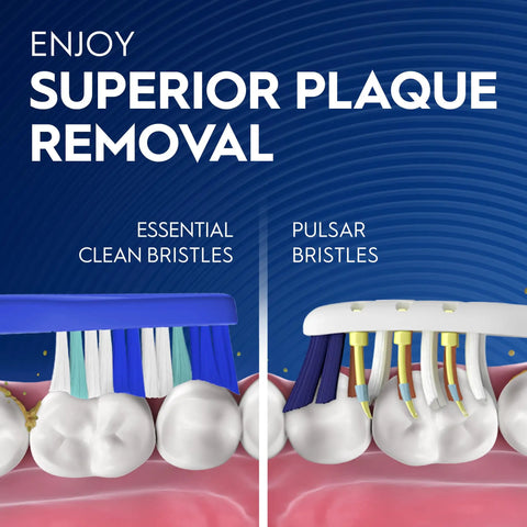 Next Level Battery Powered Electric Toothbrush With Durable Medium Bristles Eliminates Plaque And Keeps Your Brightest Smile On The Road, side view of bristle comparison for superior plaque removal.