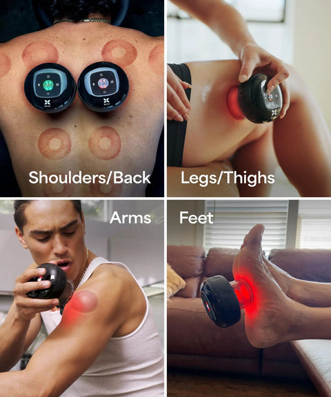 Smart Cupping Massager With LED Light And Adjustable Heat Cordless Rechargeable Vibration Therapy For Muscle Recovery Total Game Changer Smooth Full Body Relief Straight Up Top Tier Gear