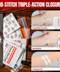 Rhino Rescue Wound Closure Kit front view: assorted bandages (butterfly, zip, dumbbell) and antibiotic ointment packets.