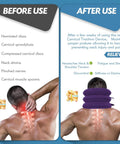 Image comparing before and after use of the Jaximy Inflatable Neck Traction Device for pain relief.