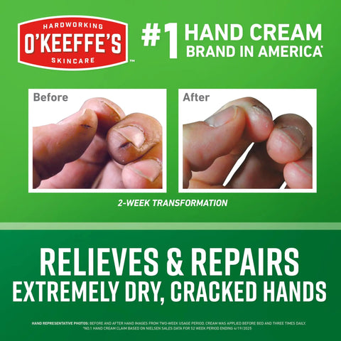 Working Hands Hand Cream For Extreme Dryness Heavy Duty Moisturizer 3.4 Oz Jar That Really Fixes Cracked Hands transformation image