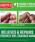 Before and after results of Working Hands Hand Cream For Extreme Dryness 6.8 Oz Value Size Jar One Pack; hand transformation images.