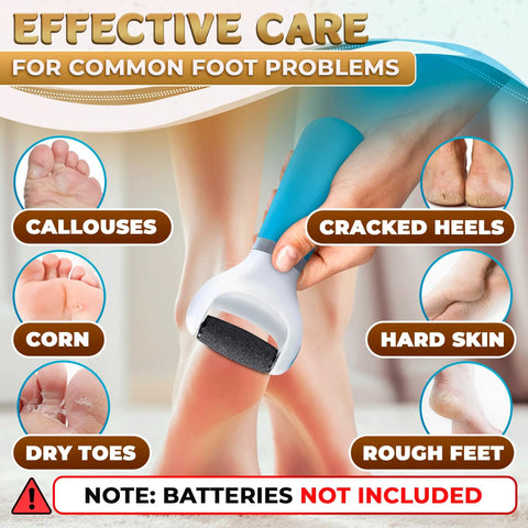 Battery Powered Foot Callus Remover For Dead Skin Exfoliation Easy At Home Pedicure Tool addressing cracked heels and callouses