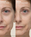 Comparison of face with and without Instant Skin Tightening Primer For Face That Blurs Imperfections Firms On Contact Reduces Fine Lines And Pores A No Filter Makeup Base For Flawless Photo Ready Skin Throughout The Day.