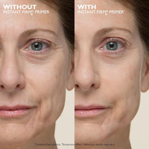 Comparison of face with and without Instant Skin Tightening Primer For Face That Blurs Imperfections Firms On Contact Reduces Fine Lines And Pores A No Filter Makeup Base For Flawless Photo Ready Skin Throughout The Day.