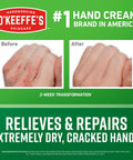 Before and after using Working Hands Hand Cream For Extreme Dryness, showing healed hands over green background.