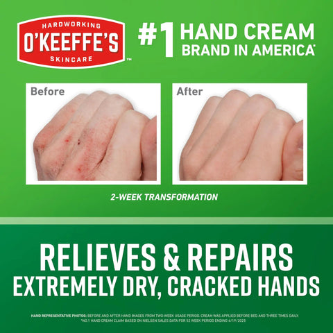 Before and after using Working Hands Hand Cream For Extreme Dryness, showing healed hands over green background.