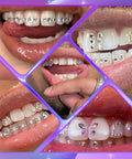 Collage of tooth gems from DIY Tooth Gem Kit With Safe Crystals, Teeth Gem Set For Fashionable Smiles, featuring multiple designs.