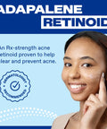 Smiling woman applying Acne Treatment Gel With 0.1 Percent Adapalene Retinoid, OTC Face Care For Clear Skin, shown close-up
