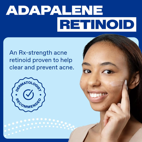 Smiling woman applying Acne Treatment Gel With 0.1 Percent Adapalene Retinoid, OTC Face Care For Clear Skin, shown close-up